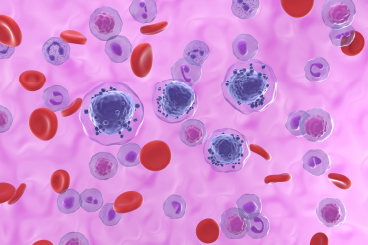 AML cells in blood